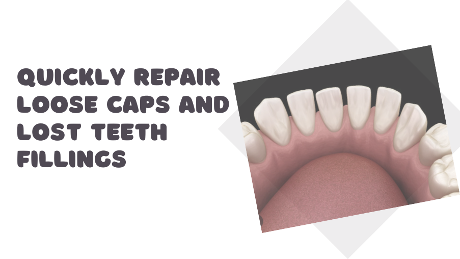 how-to-get-a-fast-fix-for-loose-caps-and-lost-teeth-fillings
