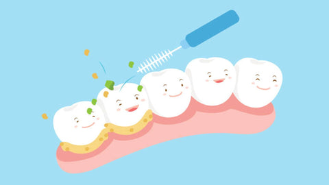 Why Should We Use Interdental Brush?