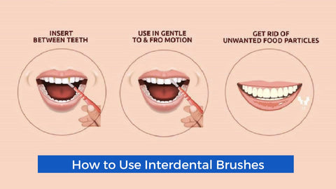 How to use an Interdental Brush Effectively